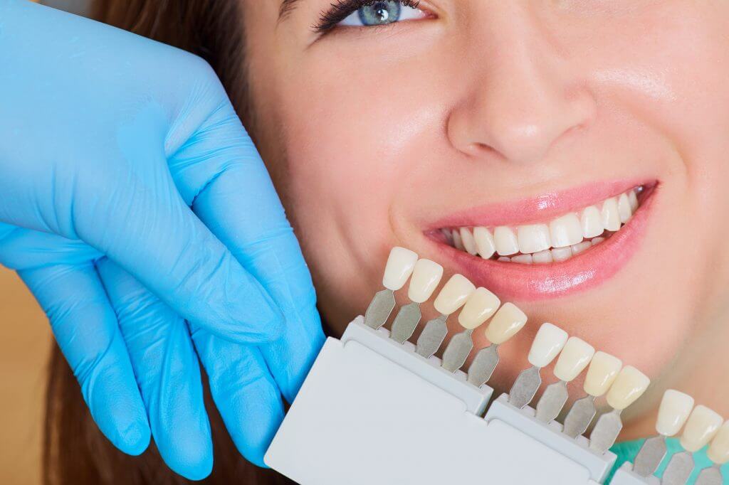 Teeth Whitening - Westend Dentist - Dentist Edmonton